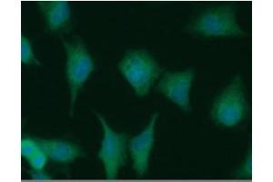 ICC/IF analysis of NUDT1 in A549 cells line, stained with DAPI (Blue) for nucleus staining and monoclonal anti-human NUDT1 antibody (1:100) with goat anti-mouse IgG-Alexa fluor 488 conjugate (Green). (NUDT1 Antikörper)