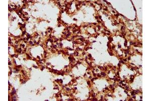 IHC image of ABIN7158336 diluted at 1:300 and staining in paraffin-embedded human lung tissue performed on a Leica BondTM system. (LMCD1 Antikörper  (AA 105-268))