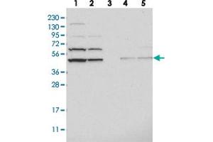 Western blot analysis of Lane 1: RT-4, Lane 2: U-251 MG, Lane 3: Human Plasma, Lane 4: Liver, Lane 5: Tonsil with ADSS polyclonal antibody  at 1:250-1:500 dilution.