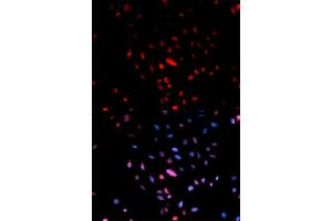 Immunofluorescence analysis of U2OS cells using Phospho-Jun-S73 antibody (ABIN5969904). (C-JUN Antikörper  (pSer73, Ser73))
