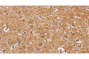 Immunohistochemistry of paraffin-embedded Human brain using CYP4A11 Polyclonal Antibody at dilution of 1:30