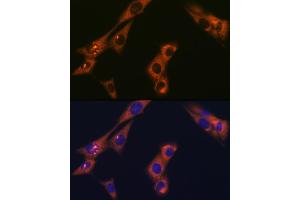 Immunofluorescence analysis of NIH-3T3 cells using  Rabbit mAb (ABIN1681069, ABIN3018897, ABIN3018898 and ABIN7101684) at dilution of 1:100 (40x lens). (alpha Adaptin Antikörper)