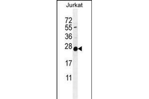 POLR2J Antibody (C-Term) (ABIN655247 and ABIN2844848) western blot analysis in Jurkat cell line lysates (35 μg/lane). (POLR2J Antikörper  (C-Term))