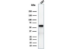Western Blot Analysis of U87 cell lysate using NGFR Recombinant Mouse Monoclonal Antibody (rNGFR/1965). (Rekombinanter NGFR Antikörper  (AA 281-421))