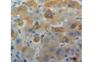 Used in DAB staining on fromalin fixed paraffin-embedded Liver tissue (APOA1 Antikörper  (AA 25-264))