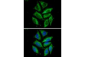anti-Mitochondrial Import Receptor Subunit TOM20 homolog (TOMM20) (AA 25-145) antibody