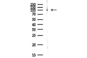 anti-Plakophilin 2 (PKP2) (N-Term) antibody