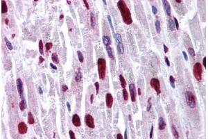 Human Heart (formalin-fixed, paraffin-embedded) stained with HIPK2 antibody ABIN214774 at 5 ug/ml followed by biotinylated goat anti-rabbit IgG secondary antibody ABIN481713, alkaline phosphatase-streptavidin and chromogen. (HIPK2 Antikörper  (AA 384-433))