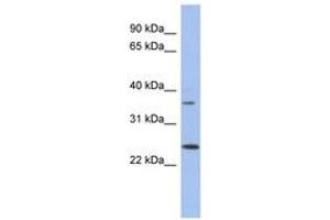 Image no. 1 for anti-WBP2 N-terminal Like (WBP2NL) (N-Term) antibody (ABIN6743704) (WBP2NL Antikörper  (N-Term))