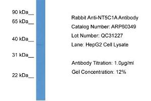 WB Suggested Anti-NT5C1A  Antibody Titration: 0. (NT5C1A Antikörper  (C-Term))