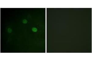 Immunofluorescence analysis of COS7 cells, using CDK1/CDC2 (Phospho-Thr14) Antibody. (CDK1 Antikörper  (pThr14))