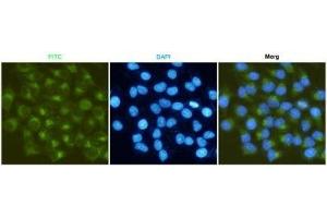 Iunofluorescent analysis of Hela cells fixed fixed by anhydrous methanol at -20 °C and using P-2 mouse mAb (dilution 1:50). (MMP2 Antikörper)
