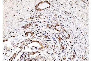 IHC analysis of IFI16 using anti-IFI16 antibody (ABIN7600374). (IFI16 Antikörper  (AA 183-743))