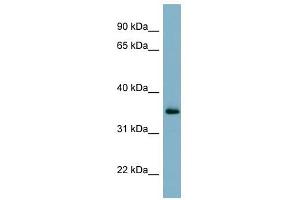 GEM antibody used at 1 ug/ml to detect target protein.