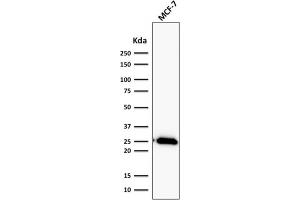ABIN6383843 to BCL2 was successfully used to stain an approx. (Rekombinanter Bcl-2 Antikörper)