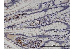 Image no. 1 for anti-Mannosyl (Alpha-1,6-)-Glycoprotein beta-1,6-N-Acetyl-Glucosaminyltransferase (MGAT5) (AA 642-740) antibody (ABIN599401) (MGAT5 Antikörper  (AA 642-740))