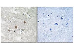 Immunohistochemistry (IHC) image for anti-Mitogen-Activated Protein Kinase Kinase Kinase 1 (MAP3K1) (pThr1402) antibody (ABIN1847608) (MAP3K1 Antikörper  (pThr1402))