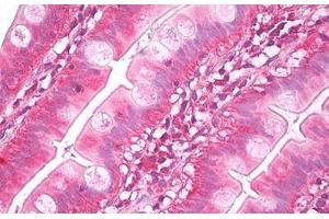 Anti-NUDT1 / MTH1 antibody IHC staining of human small intestine. (NUDT1 Antikörper)