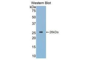 Western blot analysis of recombinant Simian CTSK. (Cathepsin K Antikörper  (AA 116-329))
