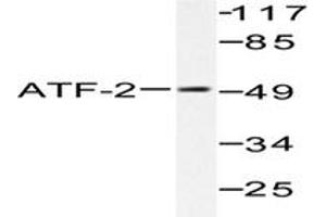 Image no. 1 for anti-Activating Transcription Factor 2 (ATF2) antibody (ABIN265318) (ATF2 Antikörper)
