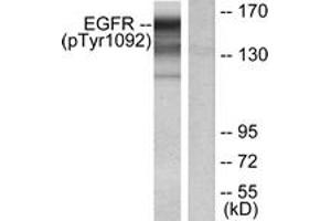 Western Blotting (WB) image for anti-Epidermal Growth Factor Receptor (EGFR) (pTyr1092) antibody (ABIN2888397) (EGFR Antikörper  (pTyr1092))