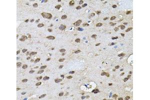 Immunohistochemistry of paraffin-embedded Rat brain using RNF166 Polyclonal Antibody (RNF166 Antikörper)