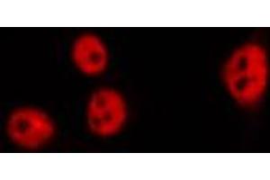 ABIN6269288 staining Hela by IF/ICC. (HDAC4 Antikörper  (Internal Region))