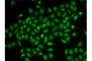 Immunofluorescence analysis of HeLa cells using COIL antibody (ABIN5973828). (Coilin Antikörper)