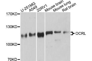 Western blot analysis of extracts of various cell lines, using OCRL antibody (ABIN5996295) at 1/1000 dilution. (OCRL Antikörper)