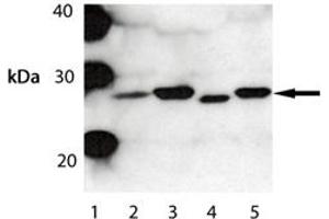 Western blot analysis of Bak . (BAK1 Antikörper)