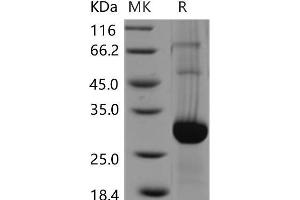 Western Blotting (WB) image for GLI Pathogenesis-Related 1 (GLIPR1) protein (His tag) (ABIN7320125) (GLIPR1 Protein (His tag))