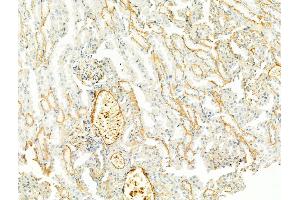 ABIN6256011 and ABIN6267476 at 1/100 staining Mouse kidney tissue by IHC-P. (Cadherin 5 Antikörper  (pTyr731))