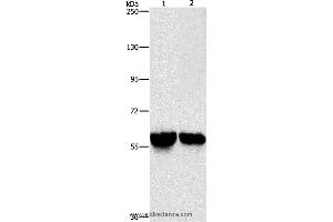 Western blot analysis of Mouse liver and kidney tissue, using ALDH8A1 Polyclonal Antibody at dilution of 1:800 (ALDH8A1 Antikörper)