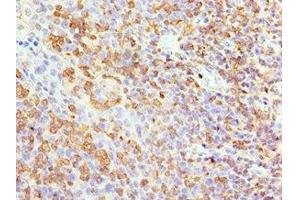 Immunohistochemistry (IHC) image for anti-Amyloid beta (A4) Precursor Protein-Binding, Family B, Member 1 Interacting Protein (APBB1IP) (AA 1-150) antibody (ABIN7144041)