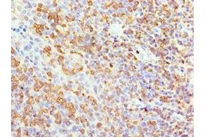 Immunohistochemistry of paraffin-embedded human tonsil tissue using ABIN7144041 at dilution of 1:100 (Amyloid beta (A4) Precursor Protein-Binding, Family B, Member 1 Interacting Protein (APBB1IP) (AA 1-150) Antikörper)