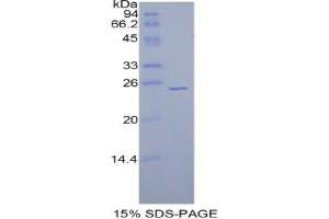 SDS-PAGE analysis of Rat GPX5 Protein.