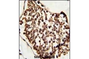 Formalin-fixed and paraffin-embedded human testis tissue reacted with SET07 Antibody, which was peroxidase-conjugated to the secondary antibody, followed by DAB staining. (SETD8 Antikörper  (N-Term))