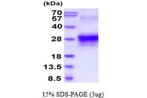 SDS-PAGE (SDS) image for Tumor Necrosis Factor (Ligand) Superfamily, Member 8 (TNFSF8) (AA 63-234) protein (His tag) (ABIN5778509) (TNFSF8 Protein (AA 63-234) (His tag))