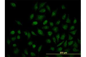 Immunofluorescence of monoclonal antibody to NR1H4 on HeLa cell. (NR1H4 Antikörper  (AA 363-472))