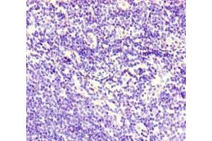 Immunohistochemistry of paraffin-embedded human lymph node tissue using ABIN7148573 at dilution of 1:100 (Corneodesmosin Antikörper  (AA 40-229))
