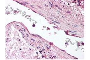 anti-ANG1 antibody was diluted 1:500 to detect ANG1 in human lung tissue. (Angiopoietin 1 Antikörper)