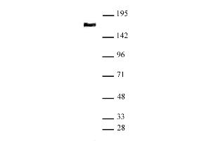 SMC4 antibody (pAb) tested by Western blot Nuclear extract of HeLa cells (20 μg) probed with SMC4 antibody (1:1,000). (SMC4 Antikörper  (N-Term))