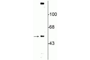 Western blot of rat striatal lysate showing specific immunolabeling of the ~57 kDa VMAT2 protein. (SLC18A2 Antikörper  (C-Term))