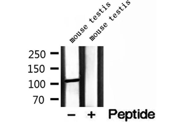 MMS19 Antikörper  (Internal Region)