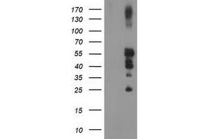 Western Blotting (WB) image for anti-Protein tyrosine Phosphatase, Non-Receptor Type 1 (PTPN1) antibody (ABIN1500496) (PTPN1 Antikörper)