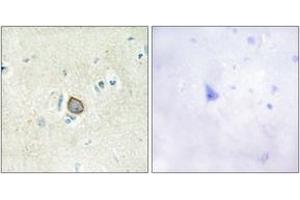 Immunohistochemistry analysis of paraffin-embedded human brain tissue, using CELSR3 Antibody. (CELSR3 Antikörper  (AA 91-140))