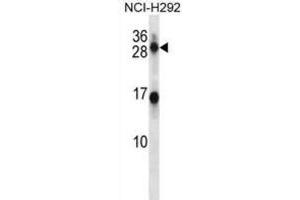 Western Blotting (WB) image for anti-Kallikrein 14 (KLK14) antibody (ABIN2998264) (Kallikrein 14 Antikörper)