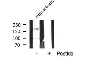 Western blot analysis of extracts from mouse brain, using CLASP1 antibody.