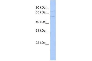 WB Suggested Anti-DLL4 Antibody Titration:  0. (DLL4 Antikörper  (N-Term))