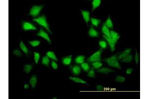 Immunofluorescence of  purified  MaxPab antibody to GENX-3414 on HeLa cell. (STBD1 Antikörper  (AA 1-358))